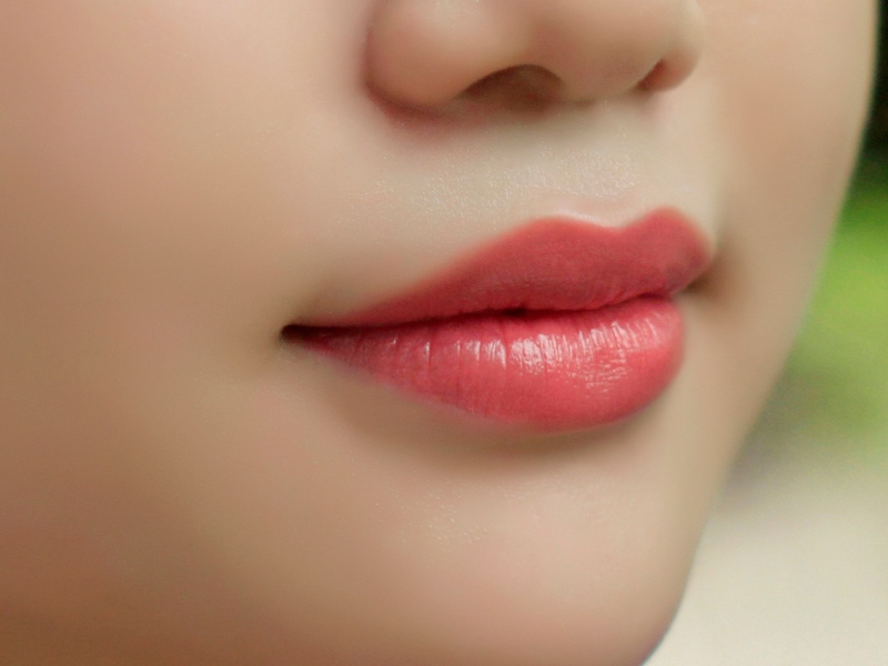 Top 9 dáng môi tiêm filler đẹp nhất hot trend hiện nay - Seoul Spa